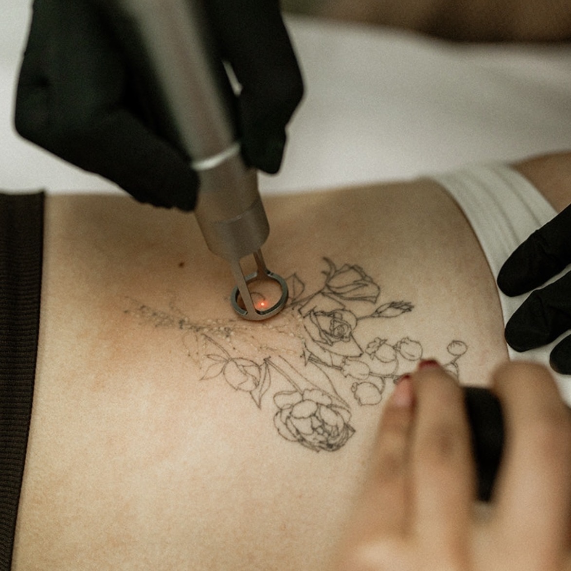 tattoo removal central coast erina black wolf collective