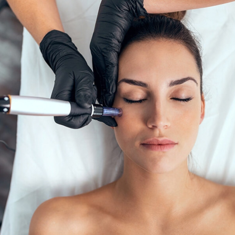 Beauty tattoo removal central coast erina black wolf collective